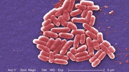 CDC announces first case of antibiotic-proof ‘superbug’