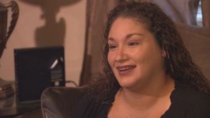 Texas woman has foreign accent syndrome after jaw surgery