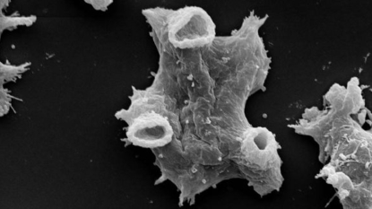 Health officials warn of brain-eating amoeba in water