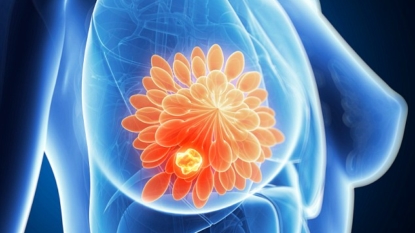 Genetic testing of tumours could personalise cancer treatment, experts say