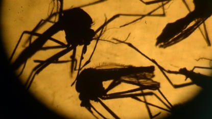 Florida Confirms Birth Defects after Mom gets Zika Abroad