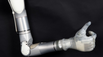 Brain-linked prosthetic arm scheduled to hit markets by year’s end