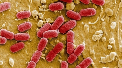 Earlier US case of superbug precursor found