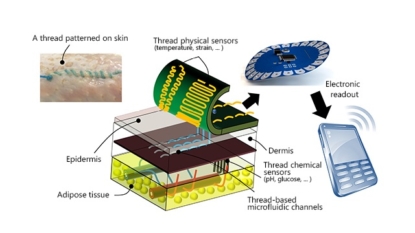 Smart surgical thread monitors healing wounds