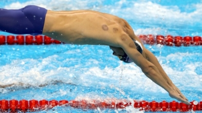 Cupping makes its mark at the Rio Olympics, thanks to Phelps