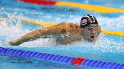 Does ‘cupping’ really help Olympians in the chase for gold?