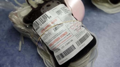 FDA Recommends Testing for Zika Virus in All US Blood Donations