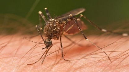 First Zika-related microcephaly cases reported in California