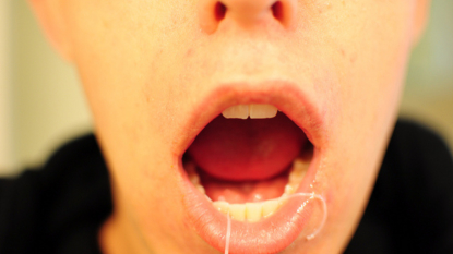 Do we really need to floss our teeth?