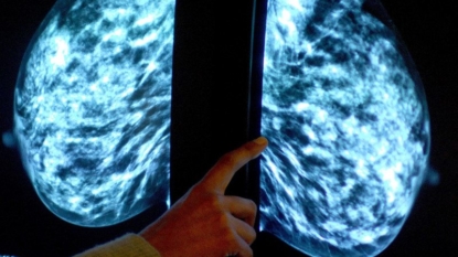 Why do women keep taking HRT despite breast cancer risks?