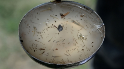 Canada reports first case of baby born with Zika-linked birth defect