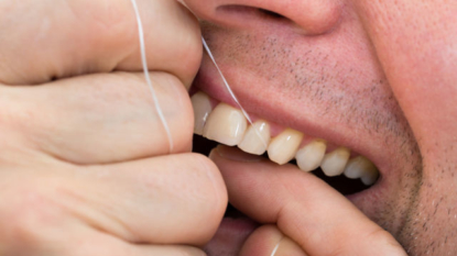 Study review finds little evidence that flossing actually helps