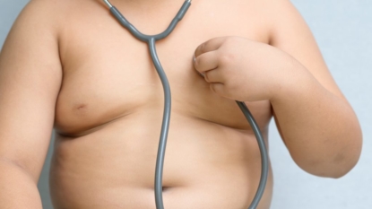 UK Government releases ‘castrated’ childhood obesity strategy