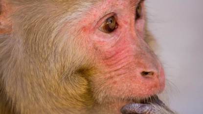 Three effective Zika vaccines block the disease in monkeys