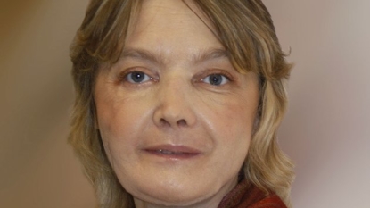 Frenchwoman who got world’s 1st face transplant dies at 49