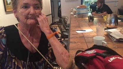 Donald Trump Supporter Punches Protester Shirley Teter, 69, In The Face