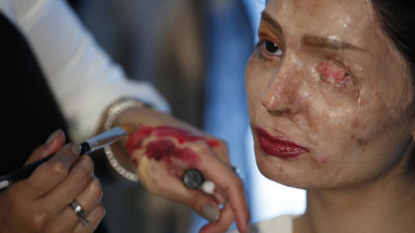 India Acid Attack Survivor Redefines Beauty at NY Fashion Week