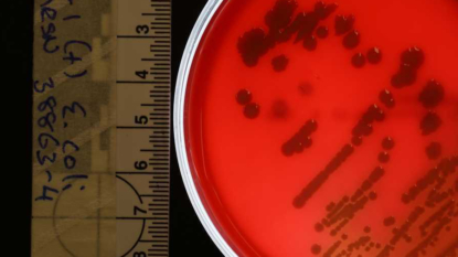 More cases of superbug precursor reported, but no spread