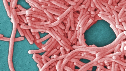 1 dead in Legionnaire’s outbreak in Minnesota