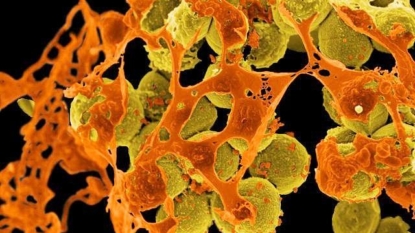 Antibiotic Resistant Bacteria Threaten Global Physical & Financial Health