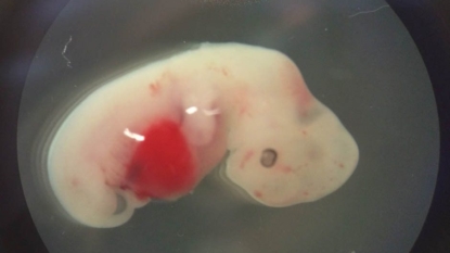 Human Cell, Pig Embryo Tests Advance Research Into Growing New Organs