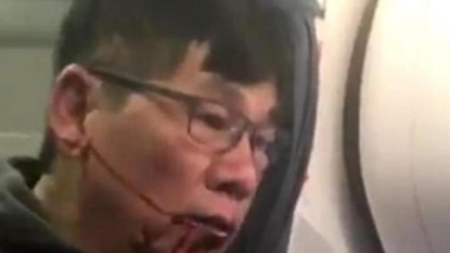 United Airlines doctor dragged off flight begins legal action